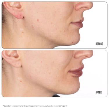 نيب + فاب جل ريتينول فيكس 10٪ لعلاج التصبغات - 15مل