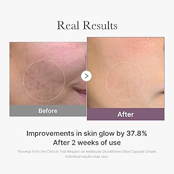 MEDICUBE GLUTATHIONE GLOW CAPSULE CREAM